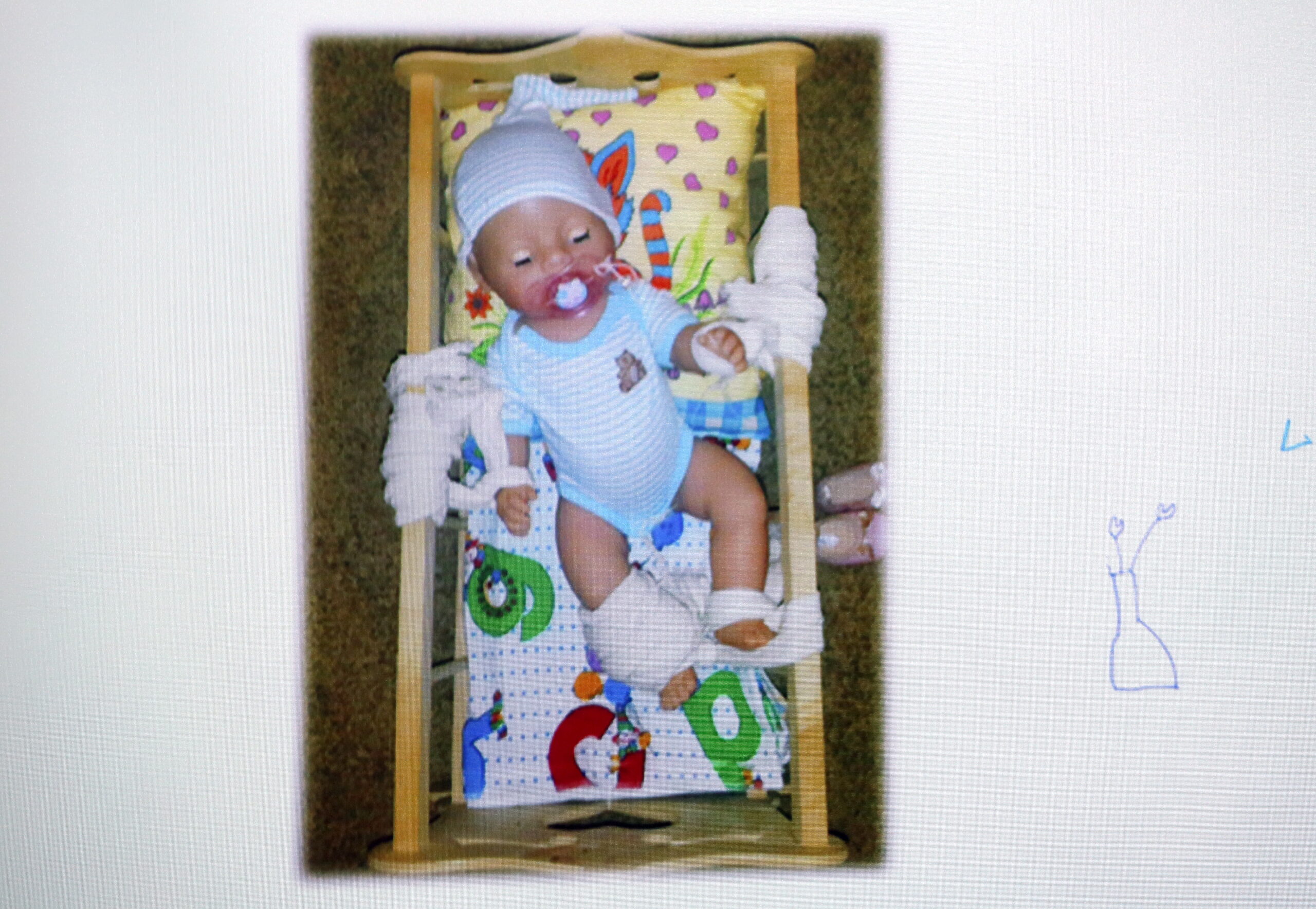 Tiesībsargs Informē Par Pārkāpumiem Bērnu Psihoneiroloģiskajā Slimnīcā 